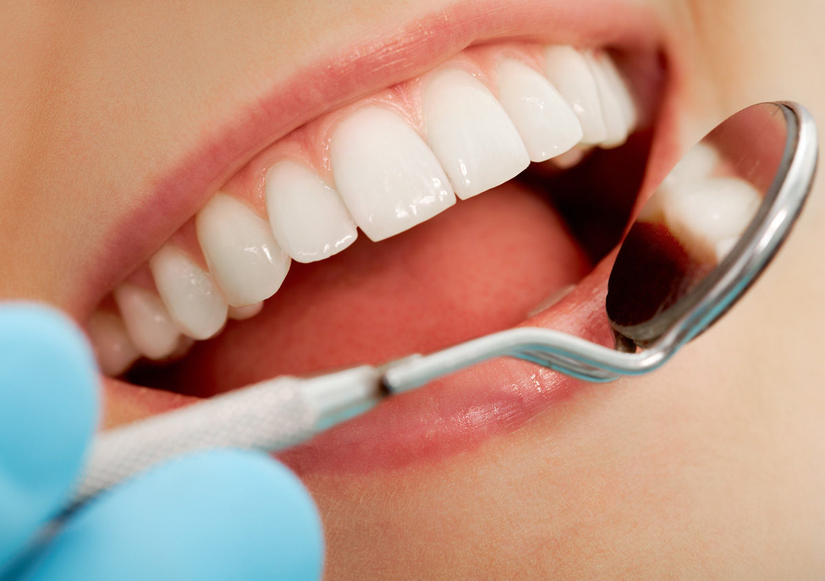How safe is dental sealants treatment in Sacramento, CA?