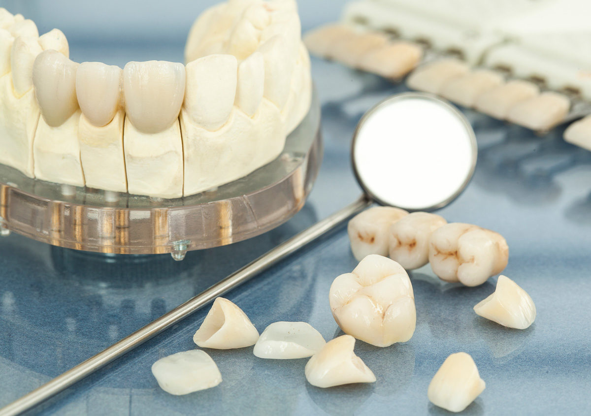 Sacramento specialists offer protection in the form of dental crowns