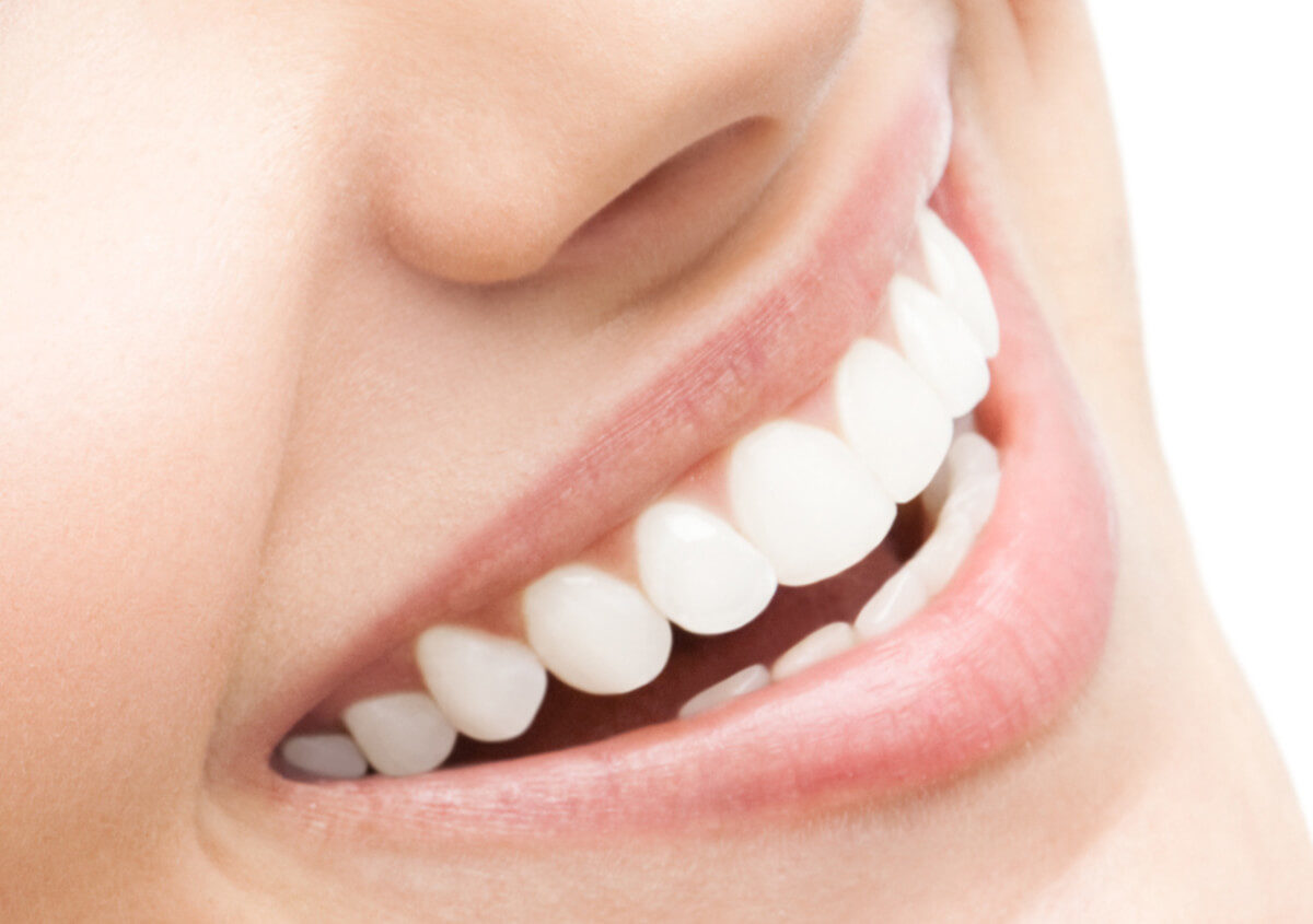 Benefits of Dental Sealants for cavity prevention