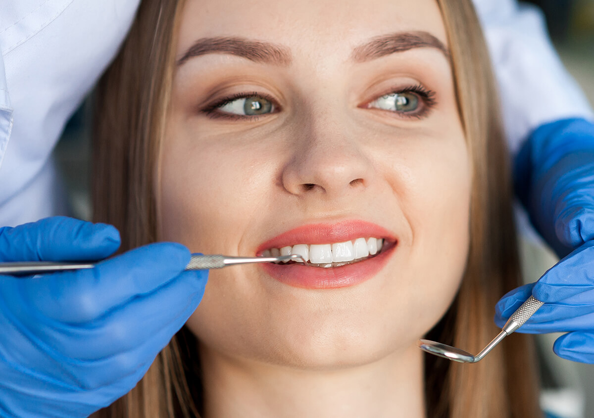 Dental Veneers Process in Sacramento Area
