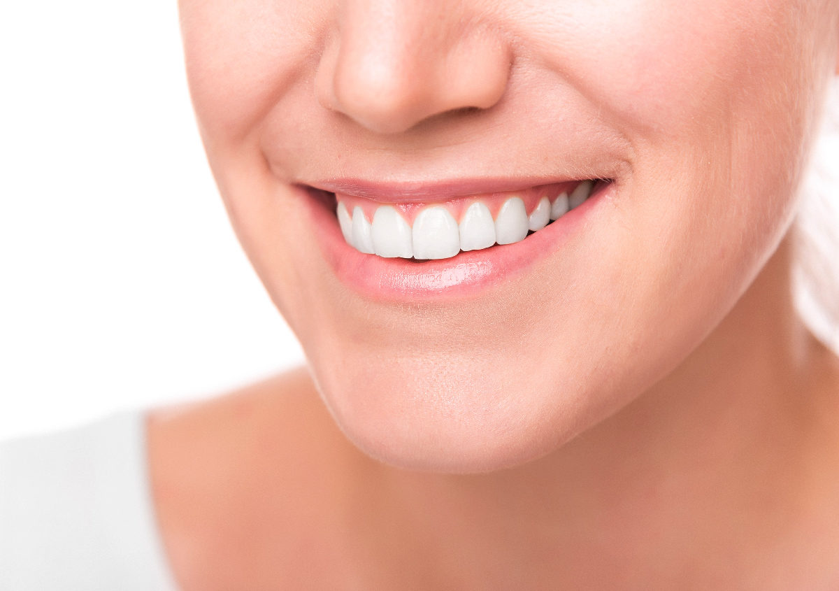 Achieve the smile of your dreams with Professional Teeth Whitening